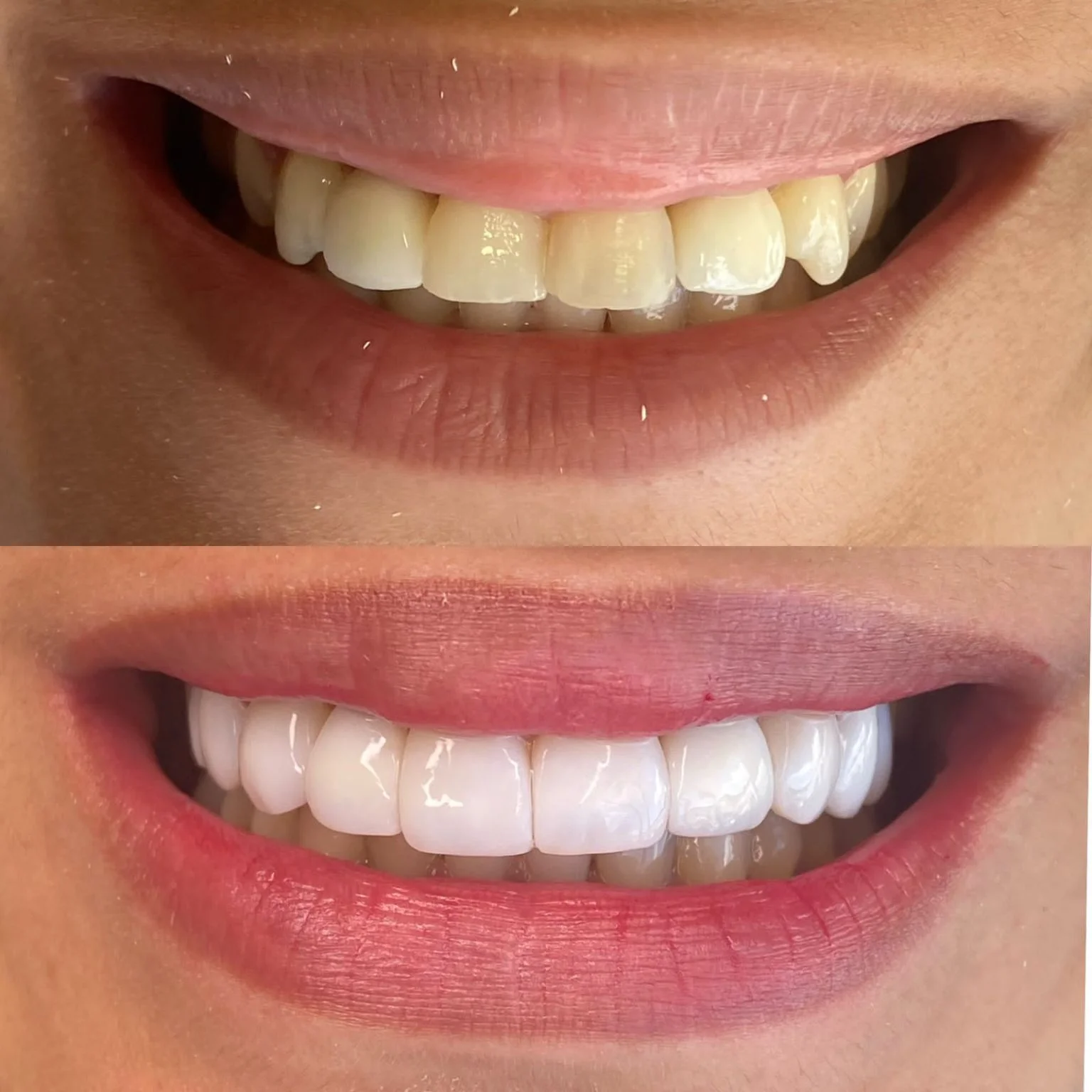 Antes e depois 3