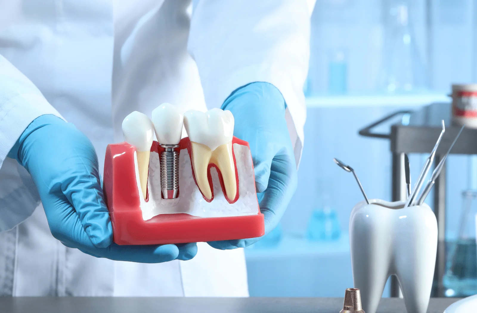 Implantes Guiados